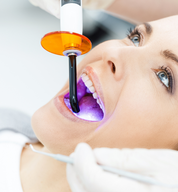 tratamentos dentários clínica benatti odontologia