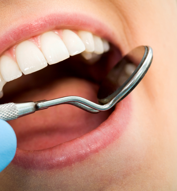 tratamentos dentários clínica benatti odontologia