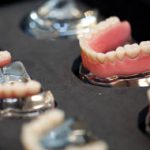 tipos de prótese dentária benatti odontologia