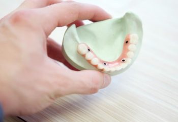 Implantes Dentários — Qual A Diferença Entre Cada Tipo?