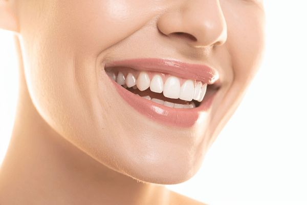 clareamento dental