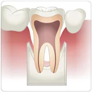 efeitos da doença periodontal