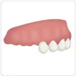 cirurgia de implante dentário