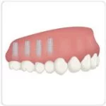 cirurgia de implante dentário
