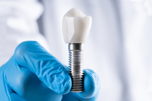 implante dentário de titânio